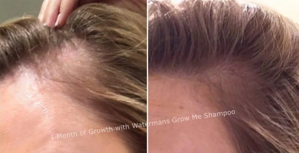 Grow Me Shampoo - For Men & Women