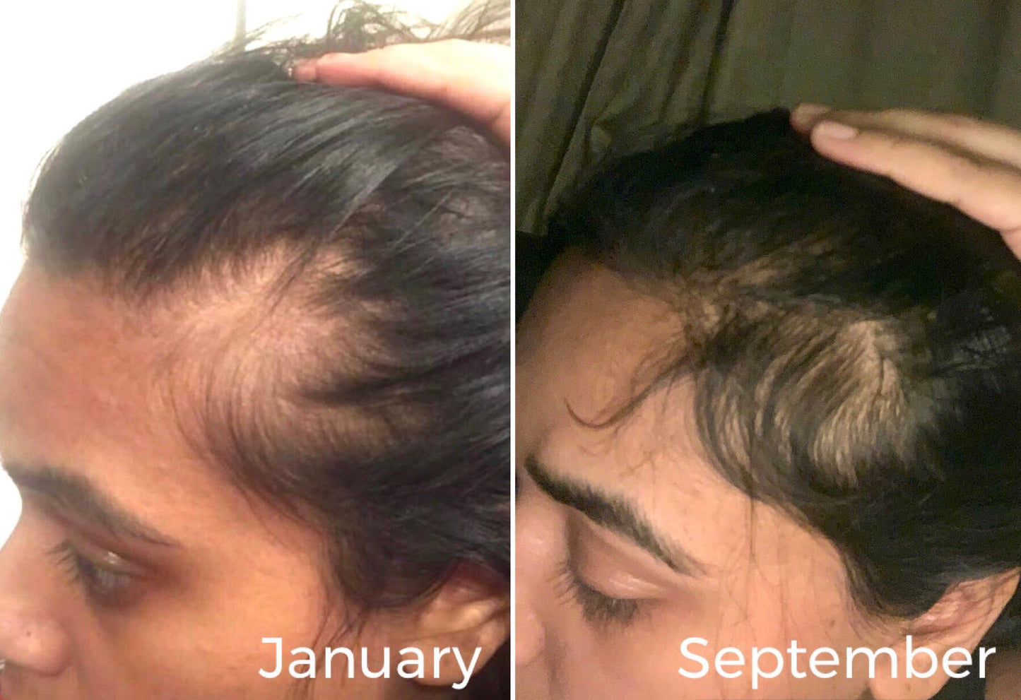Shampoo & Conditioner, Elixir leave-in scalp treatment. Hair Survival Kit - ๐ฅ MOST POPULAR