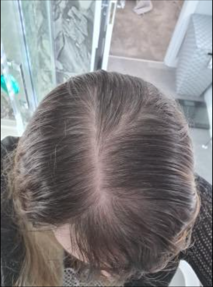 Hair Building Fibers - For Men & Women | Instant Hair thickener (Dark brown)