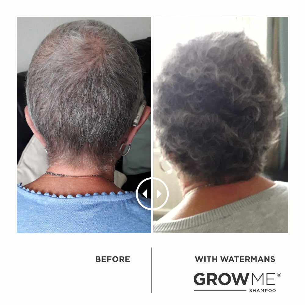 Shampoo & Conditioner, Elixir leave-in scalp treatment. Hair Survival Kit - ๐ฅ MOST POPULAR