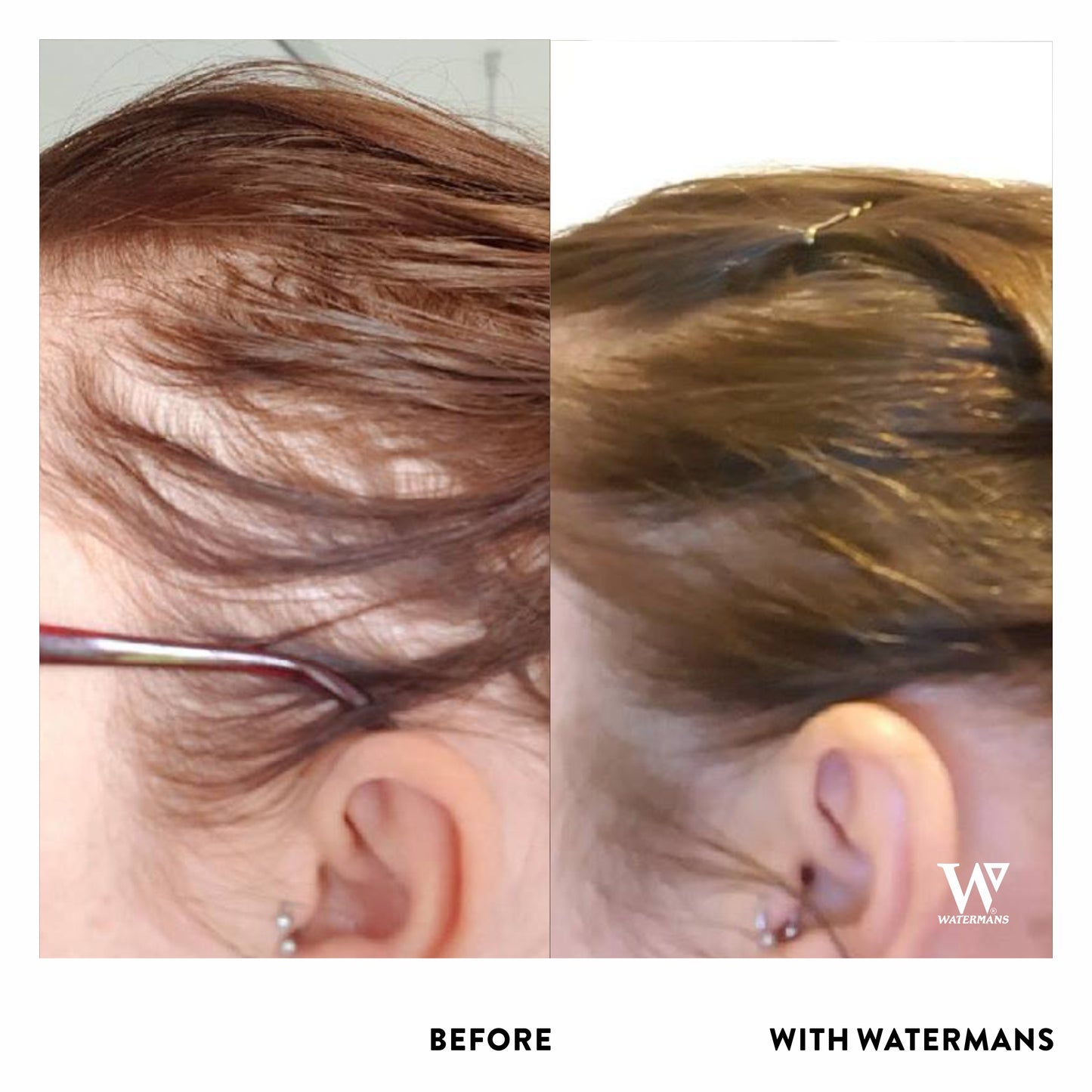Shampoo & Conditioner, Elixir leave-in scalp treatment. Hair Survival Kit - ๐ฅ MOST POPULAR