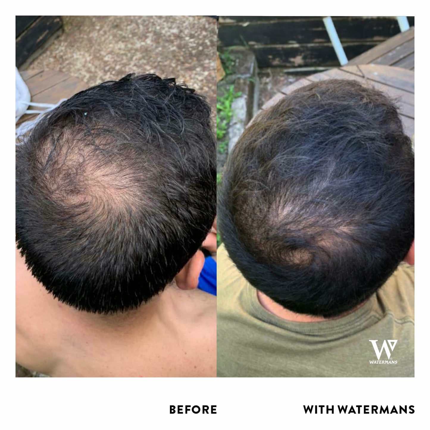 Grow Me Shampoo - For Men & Women