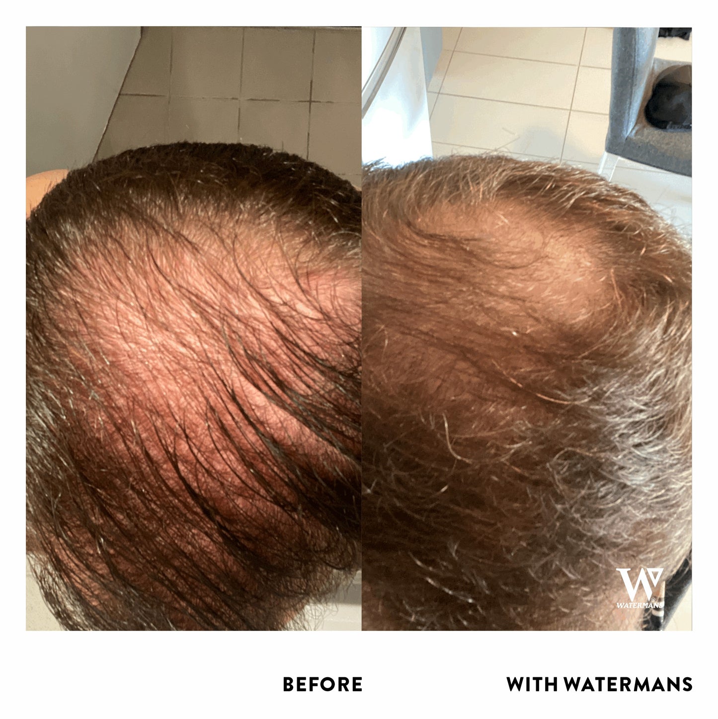 Grow Me Shampoo - For Men & Women