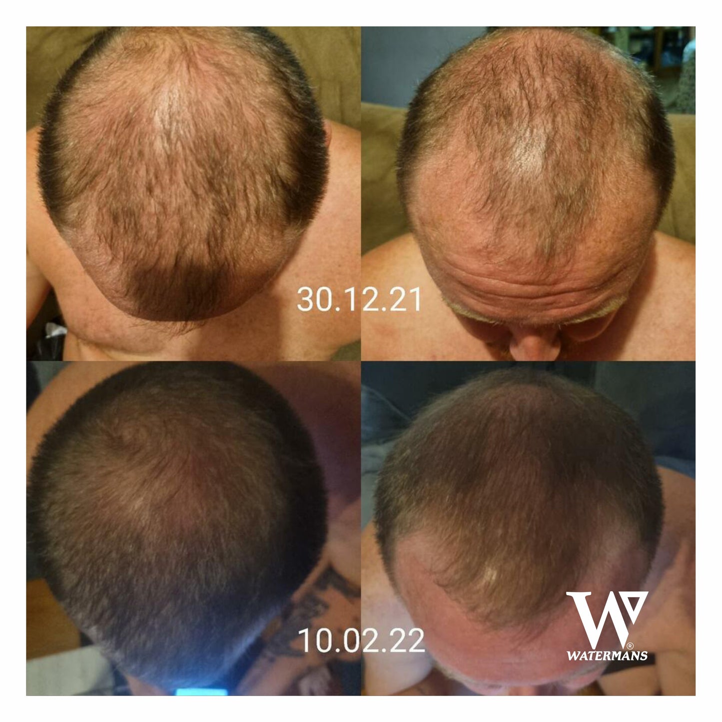 Grow Me Shampoo - For Men & Women