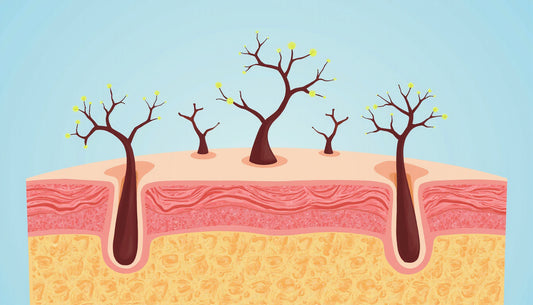 progesterone hair loss: why it happens and how to stop