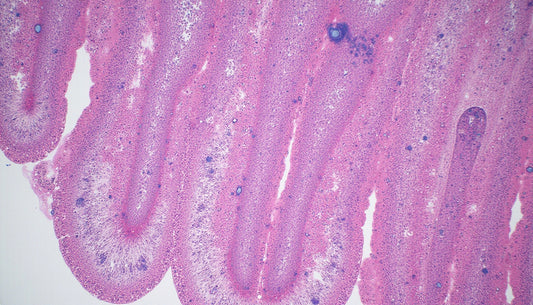 androgen receptor expression predicts aggressive tumors and guides therapy