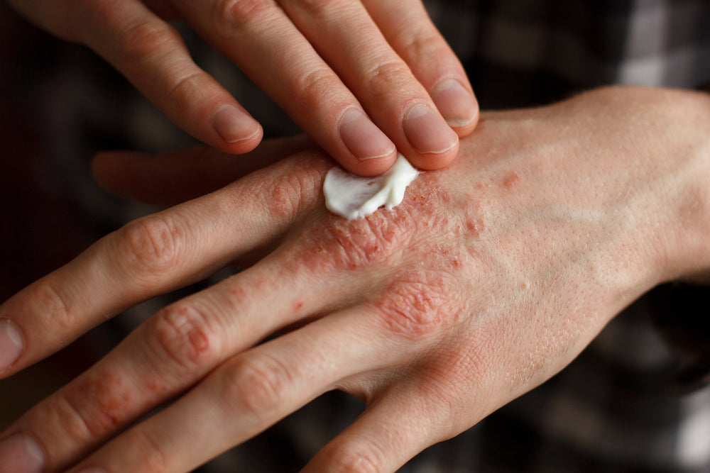 Hand Repair Cream For Dry, Cracked Hands, Anti wrinkle cream