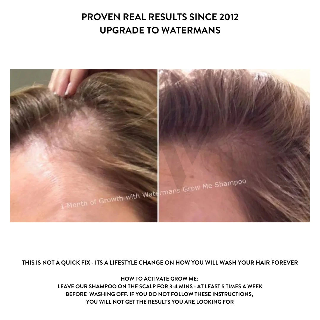 Grow More Scalp Elixir + Hair density Treatment, Hair Loss Serum