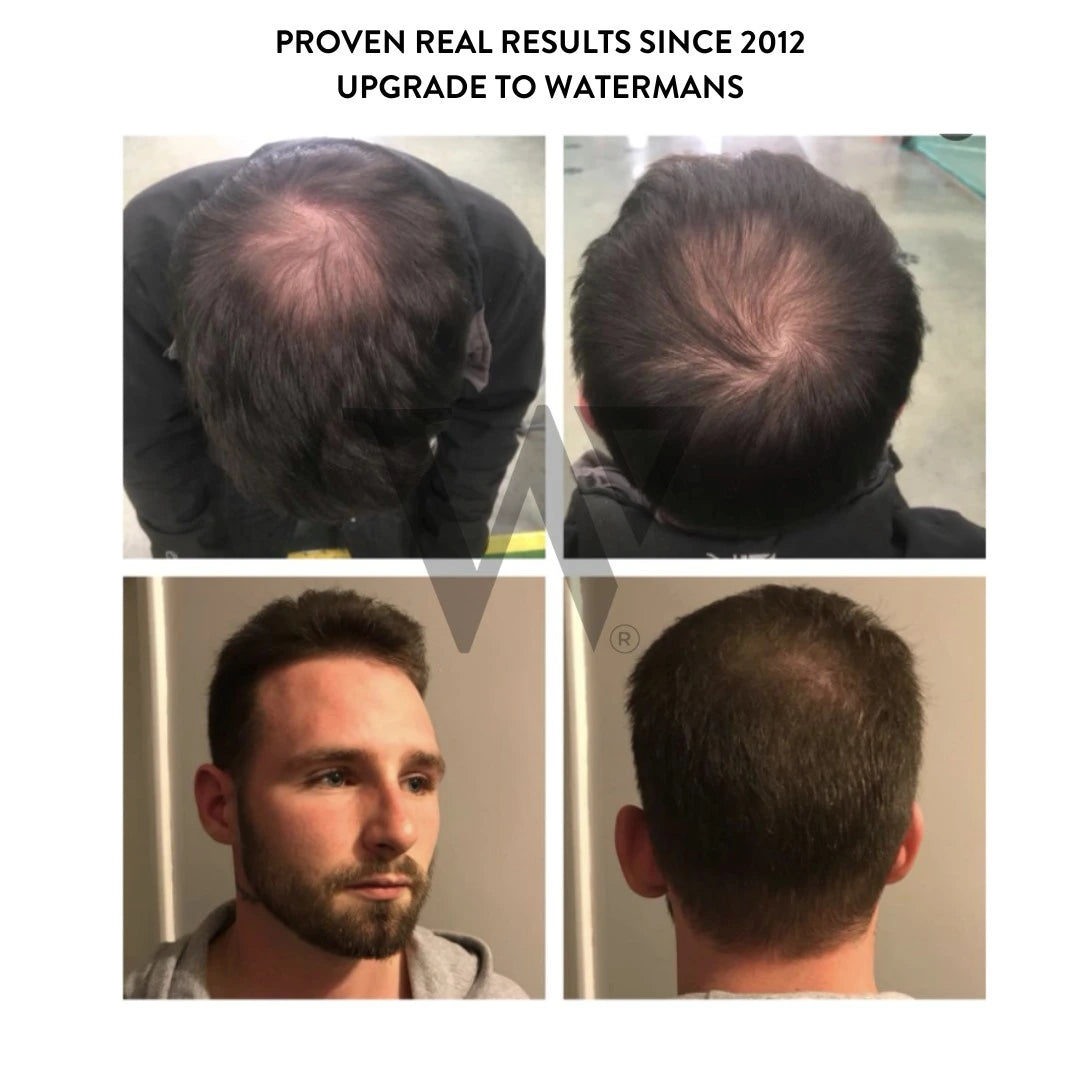 Grow More Scalp Elixir + Hair density Treatment, Hair Loss Serum