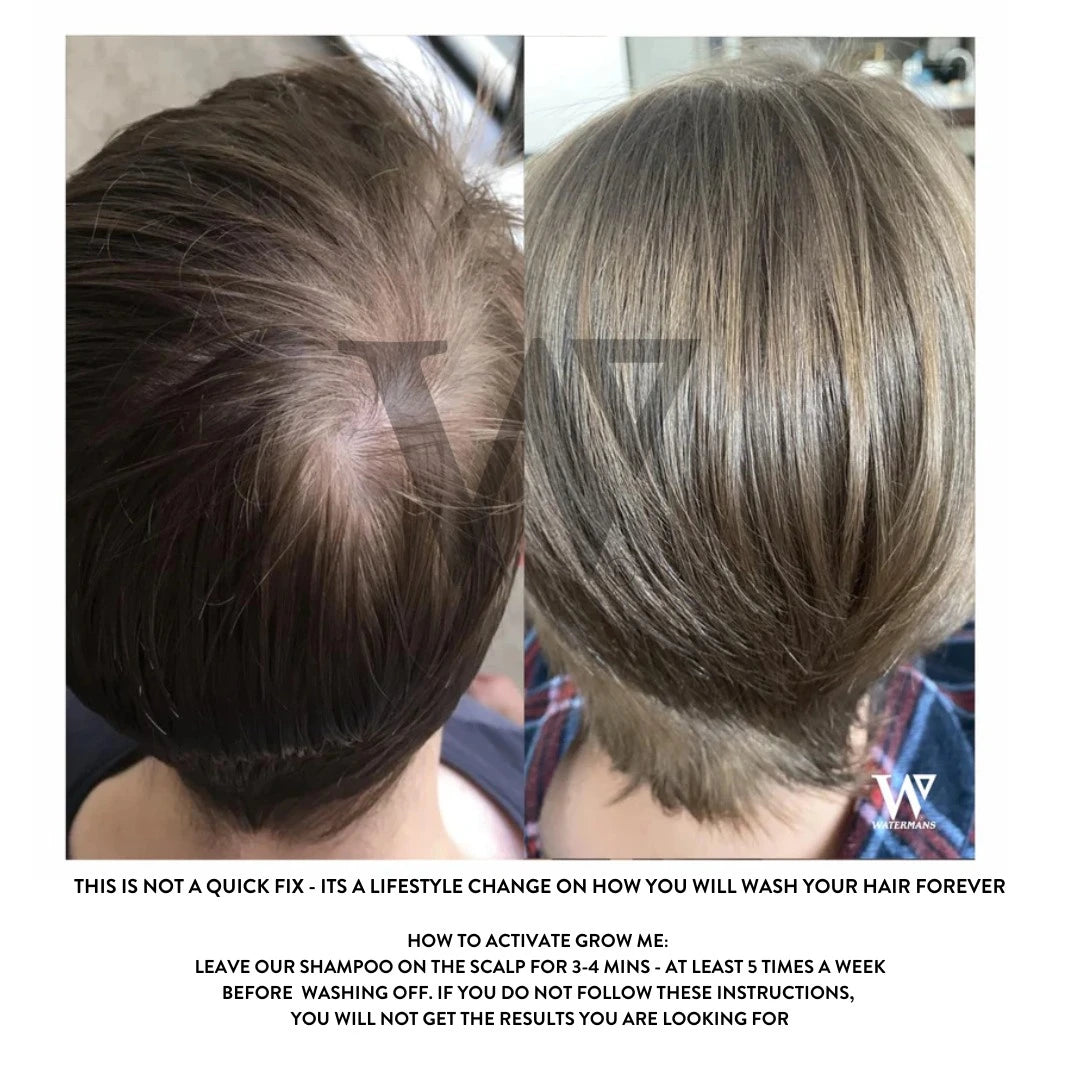 Grow More Scalp Elixir + Hair density Treatment, Hair Loss Serum