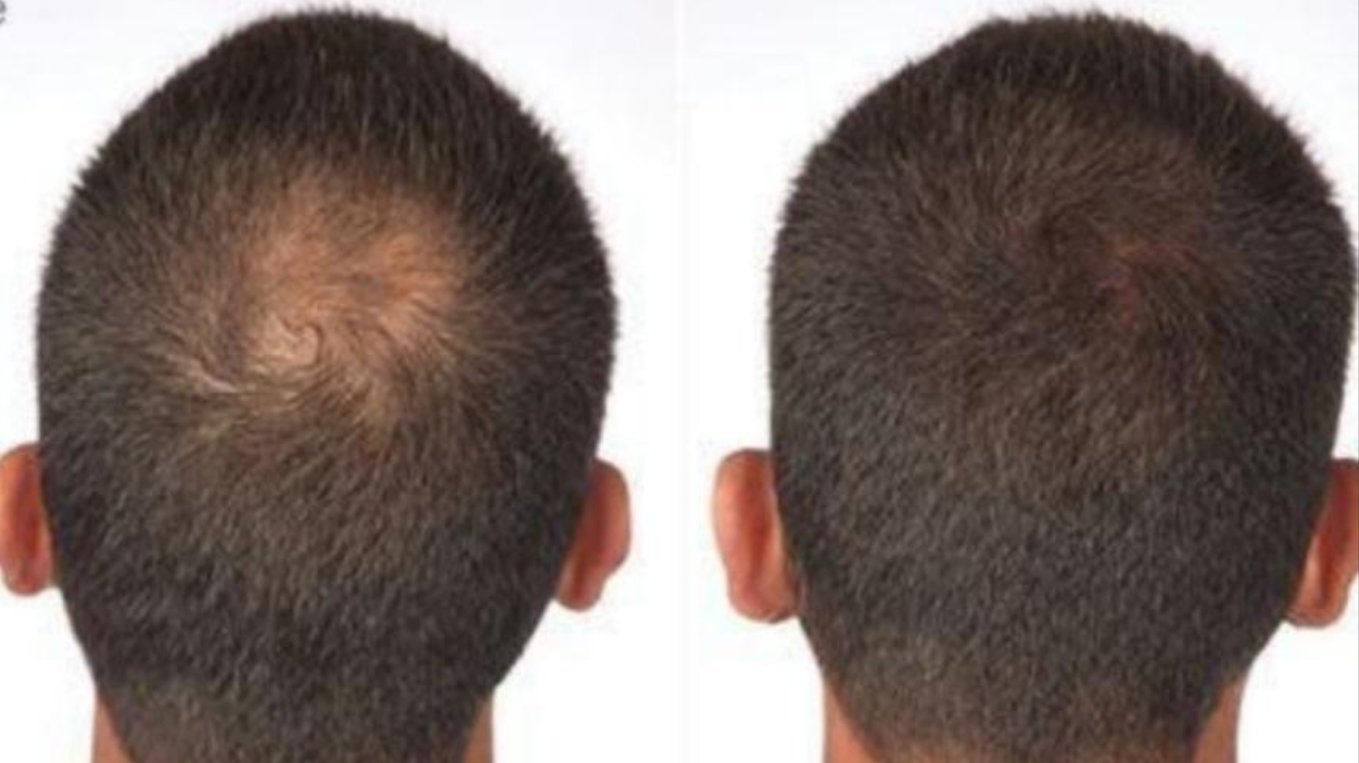 Hair Building Fibers - For Men & Women |  Instant Hair thickener (Dark brown)
