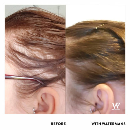 Shampoo and Conditioner with Scalp Density Elixir Treatment Solution