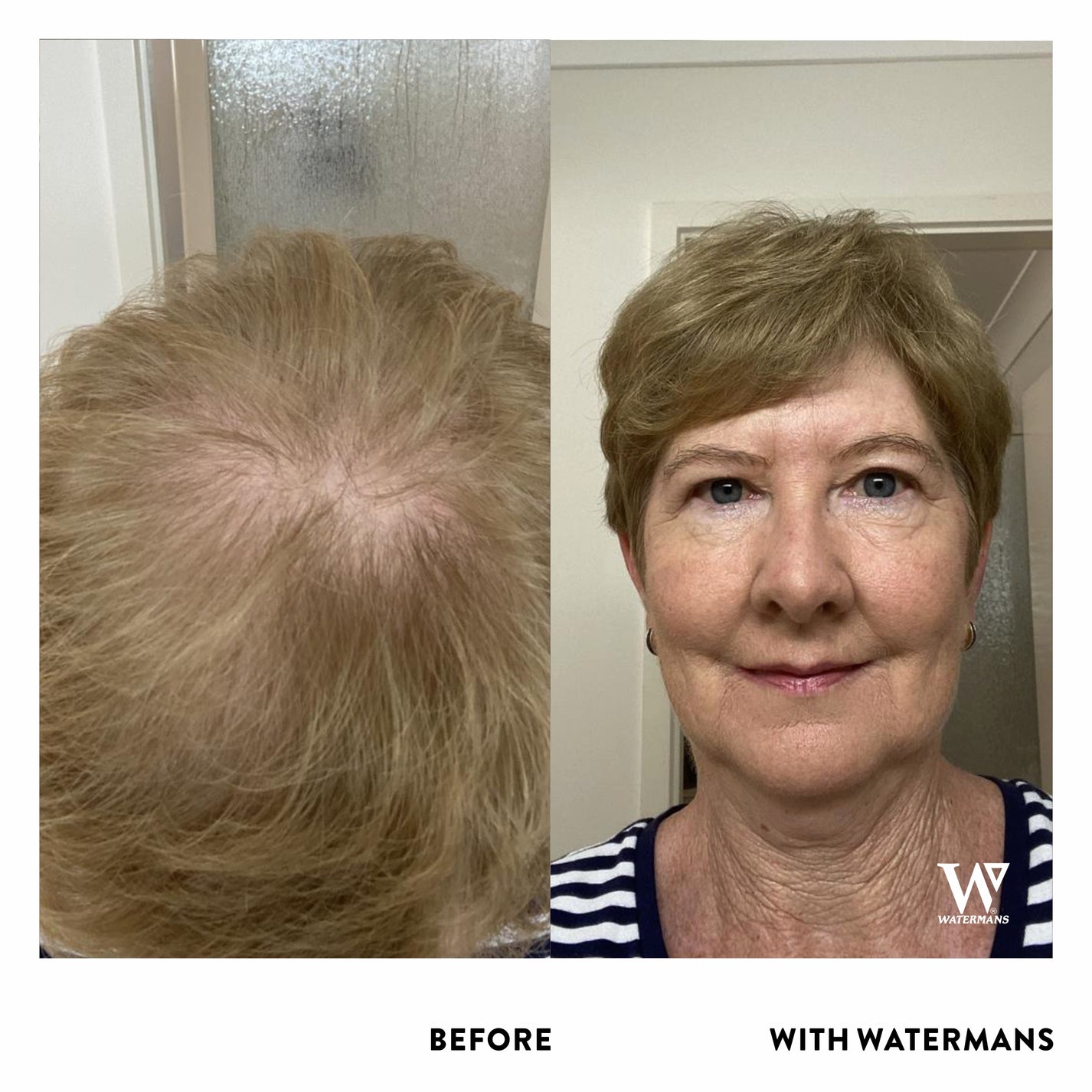 Menopause Relief Kit Menopause Hair Loss Shampoo and Supplements