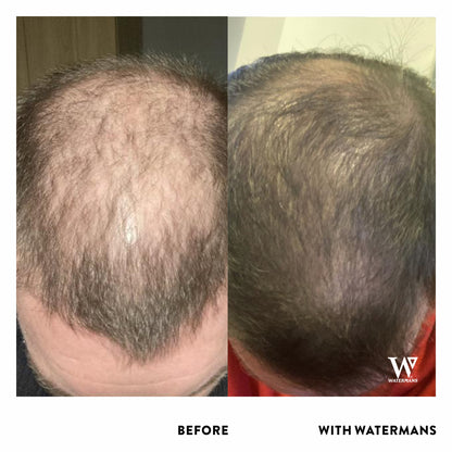 Shampoo and Conditioner with Scalp Density Elixir Treatment Solution