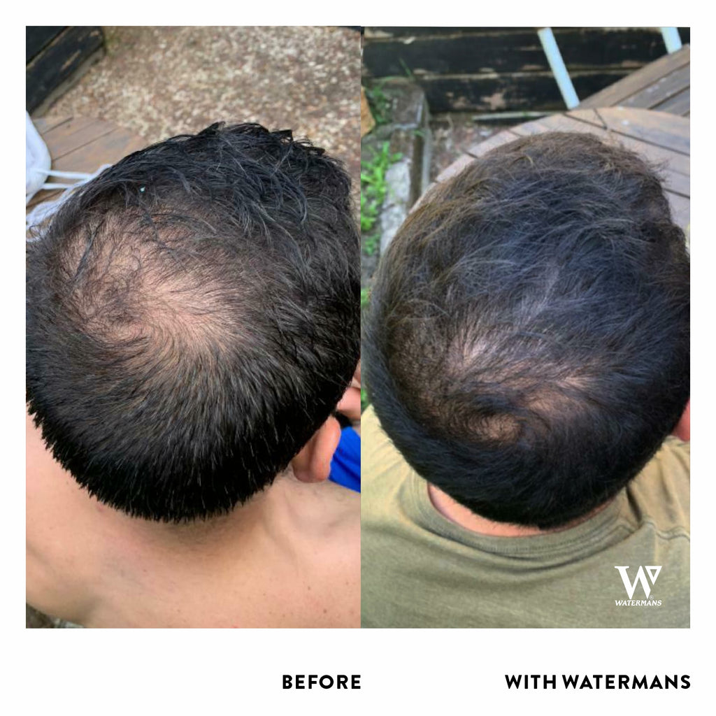 GrowMe Shampoo - For Men