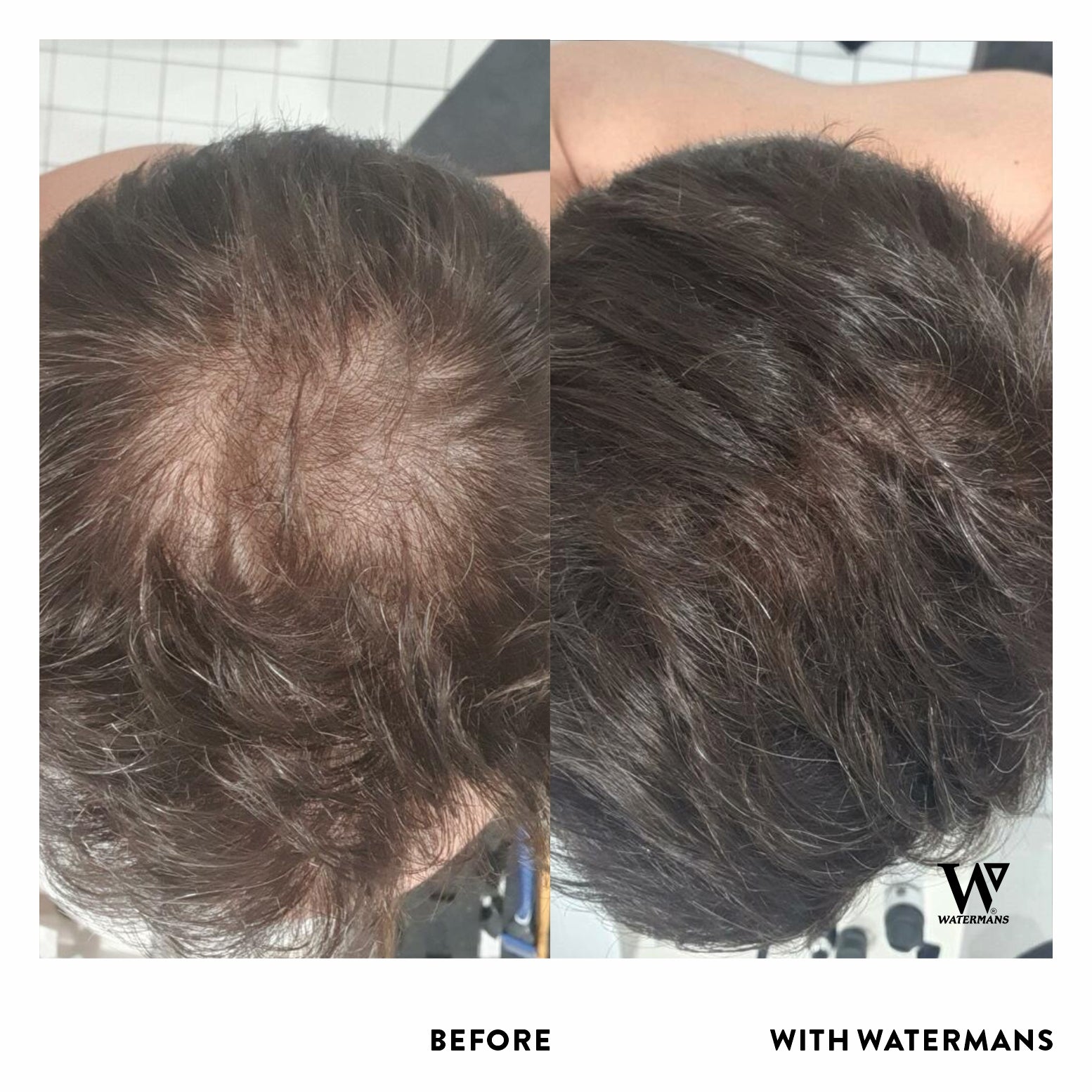 Watermans Hair Growth Shampoo and Conditioner Set - Best seller ...